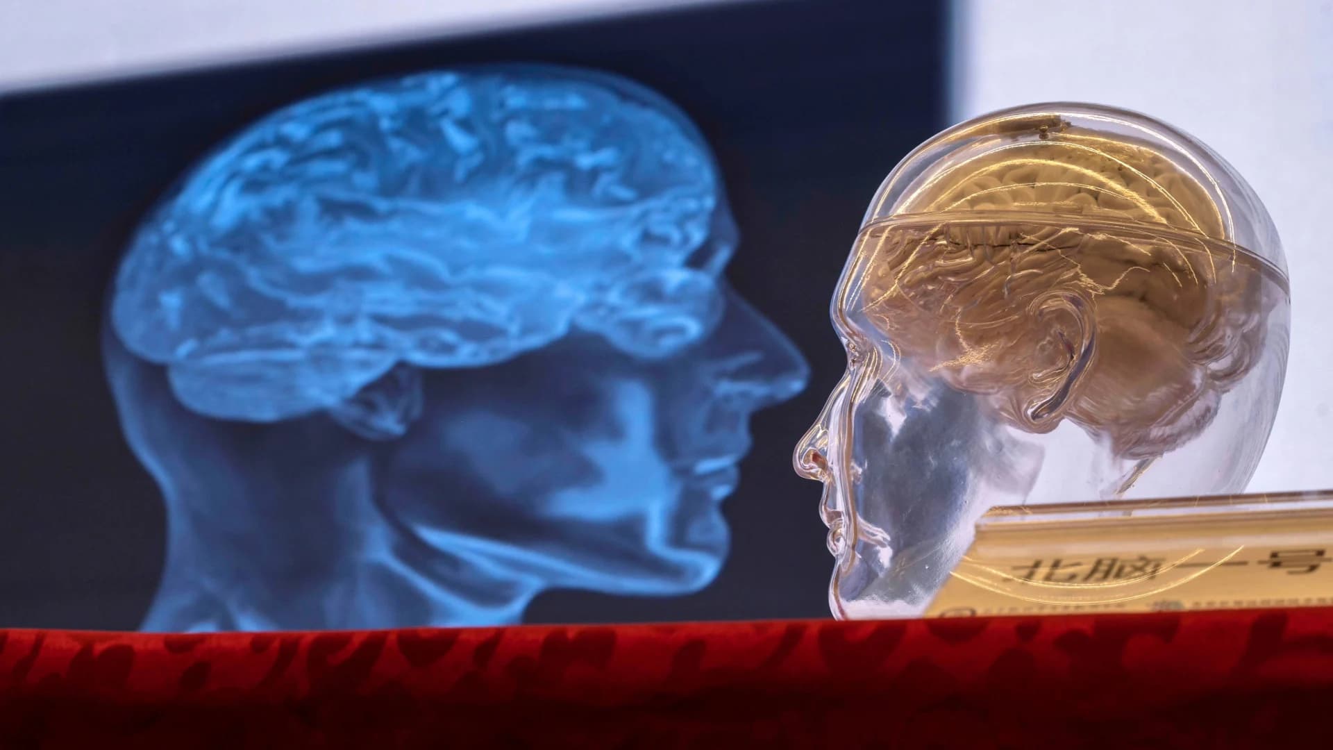 Brain Science of 'SuperAgers' Offers Hope Against Alzheimer's