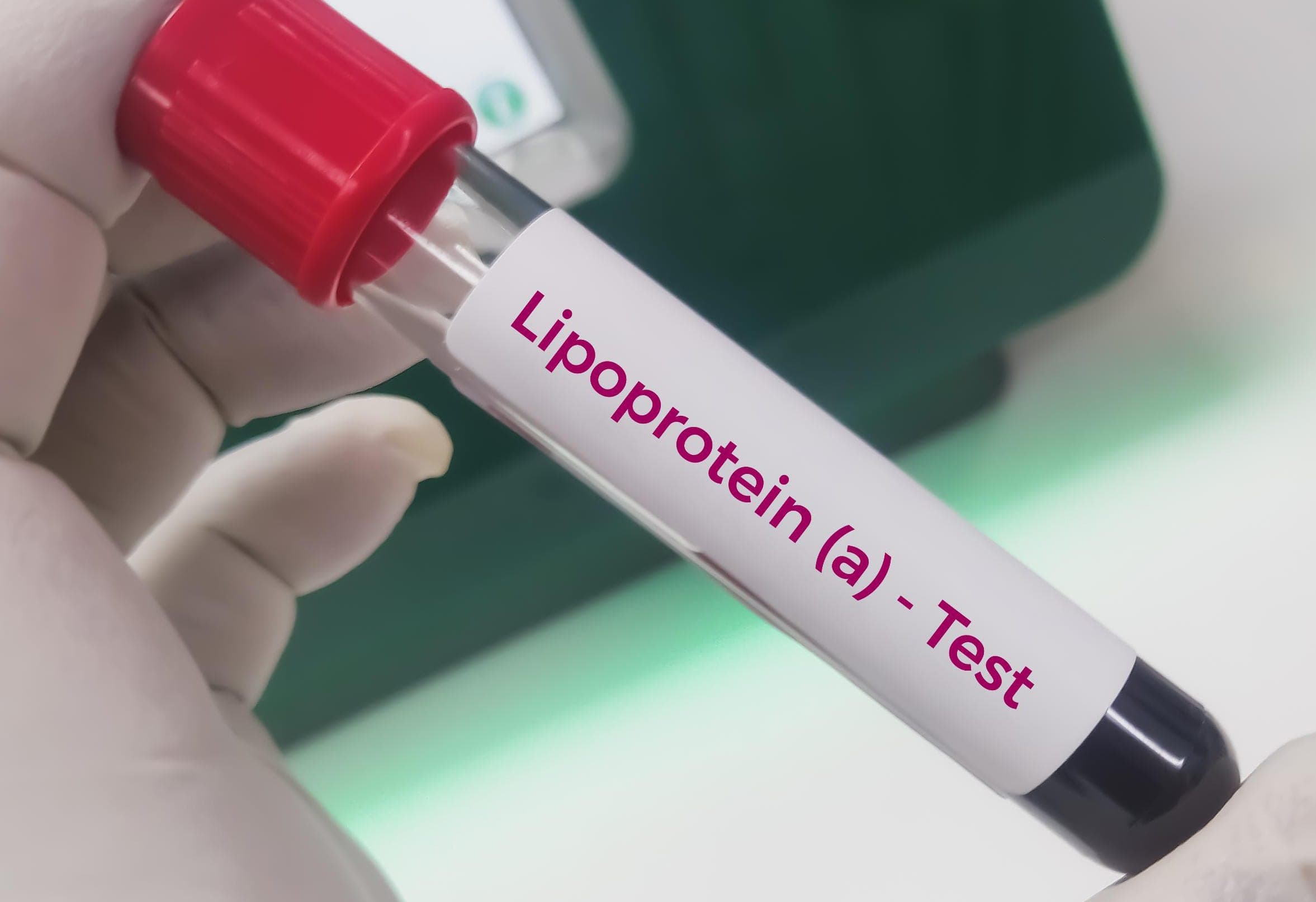 Big Pharma Eyes New Cholesterol Target for Cardiology Blockbusters