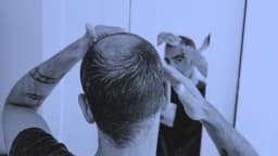 Oral Hair Loss Drug Poised to Disrupt Billion-Dollar Market